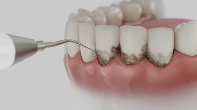 Trusted Emergency Dentist service in Ottawa Hills, OH - Dentist Open Now